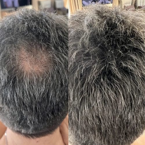 Camuflagem Capilar Profissional FixHair - Direct Ofertas