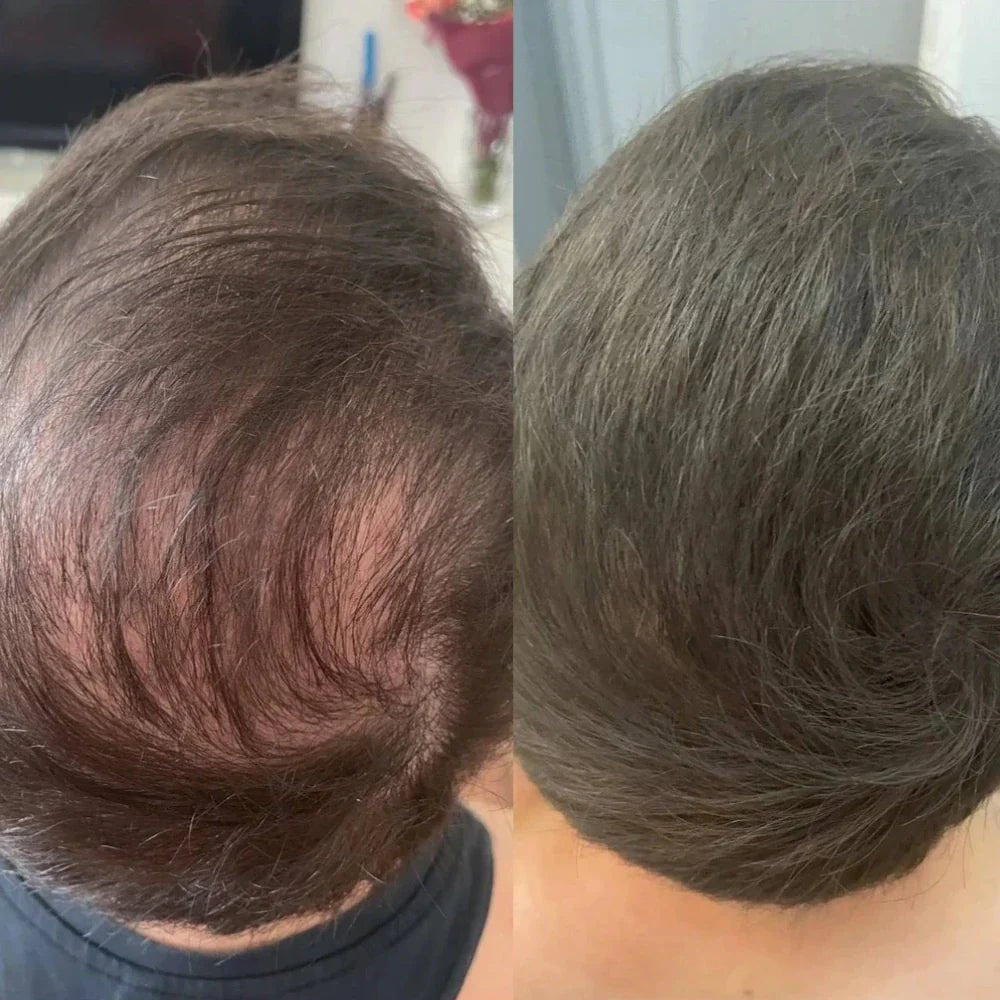 Camuflagem Capilar Profissional FixHair - Direct Ofertas