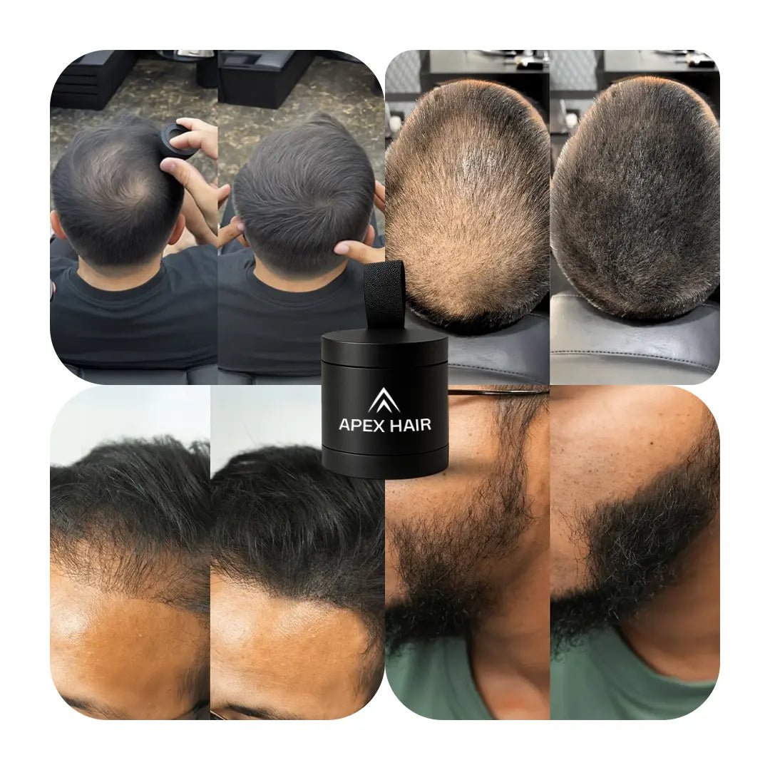 Camuflagem Capilar Profissional FixHair - Direct Ofertas