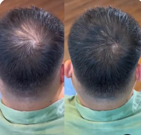 Camuflagem Capilar Profissional FixHair - Direct Ofertas