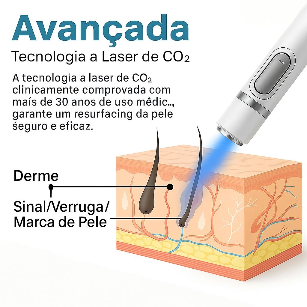 Caneta Laser MediSkin™ – Remove Manchas, Verrugas e Sinais Sem Dor - Direct Ofertas