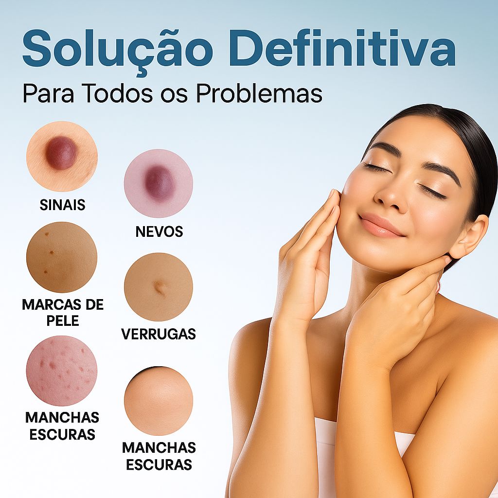 Caneta Laser MediSkin™ – Remove Manchas, Verrugas e Sinais Sem Dor - Direct Ofertas