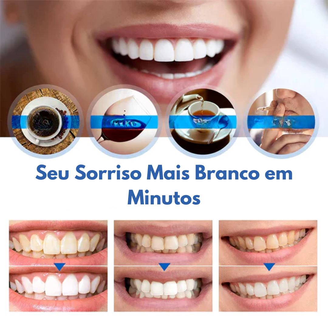 Clareador Dental Ultra White - Denting |COMPRE 1 LEVE 2| - Direct Ofertas