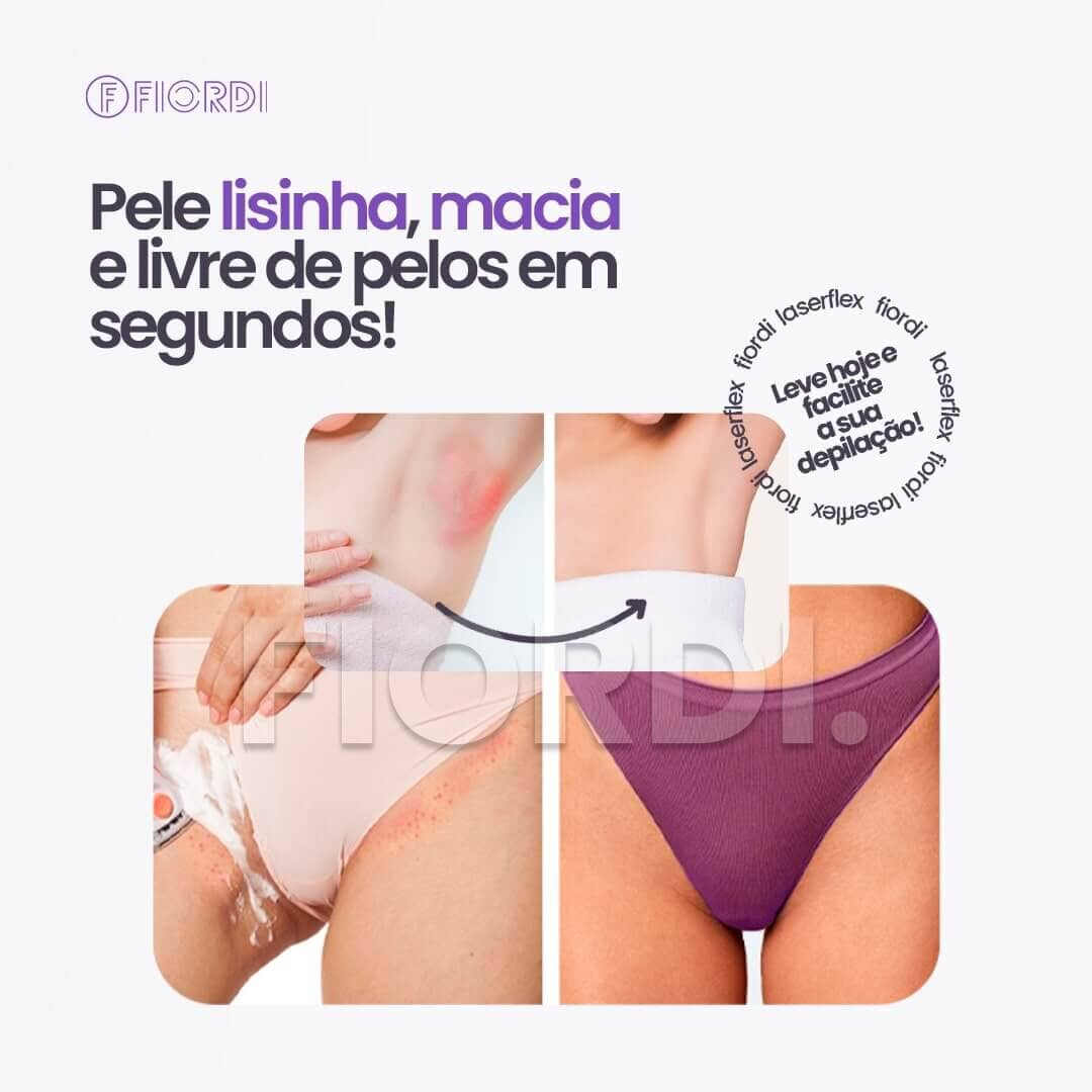 Depilador Laser Indolor 2 em 1 [FRETE GRÁTIS] - Direct Ofertas