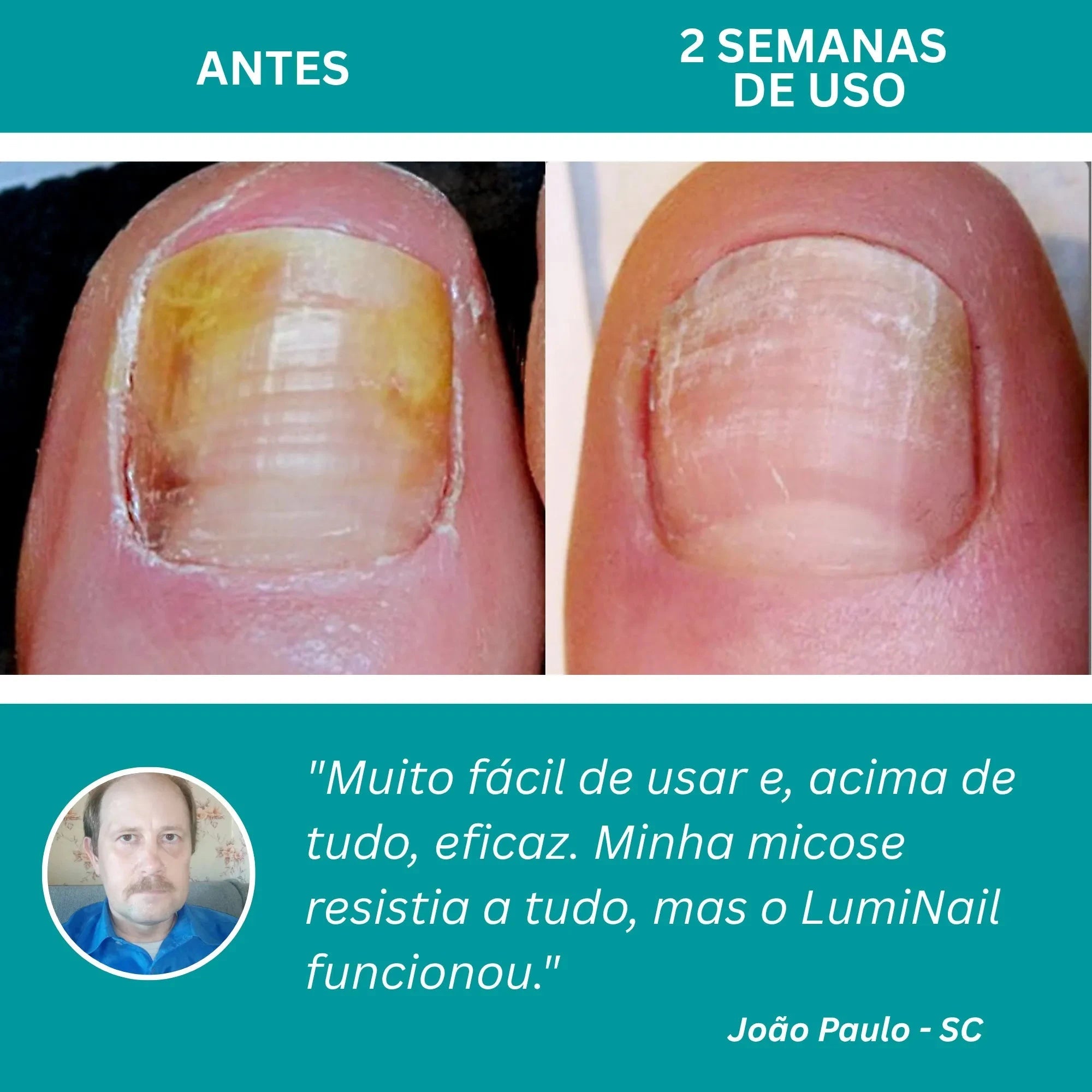 LumiNail Pro - Direct Ofertas