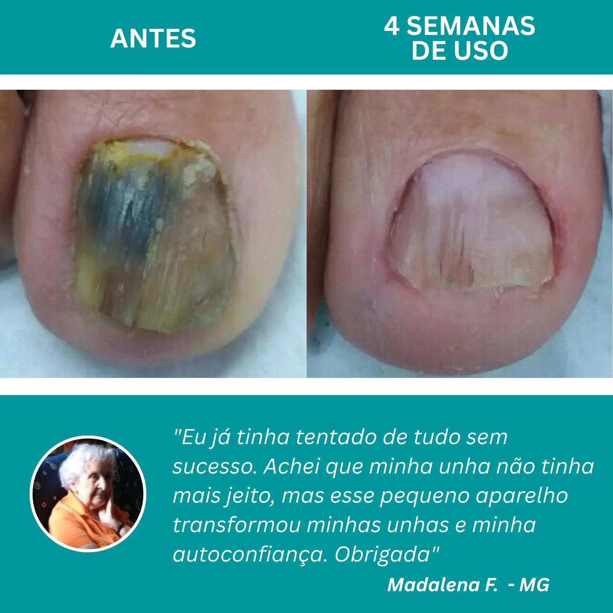 LumiNail Pro - Direct Ofertas