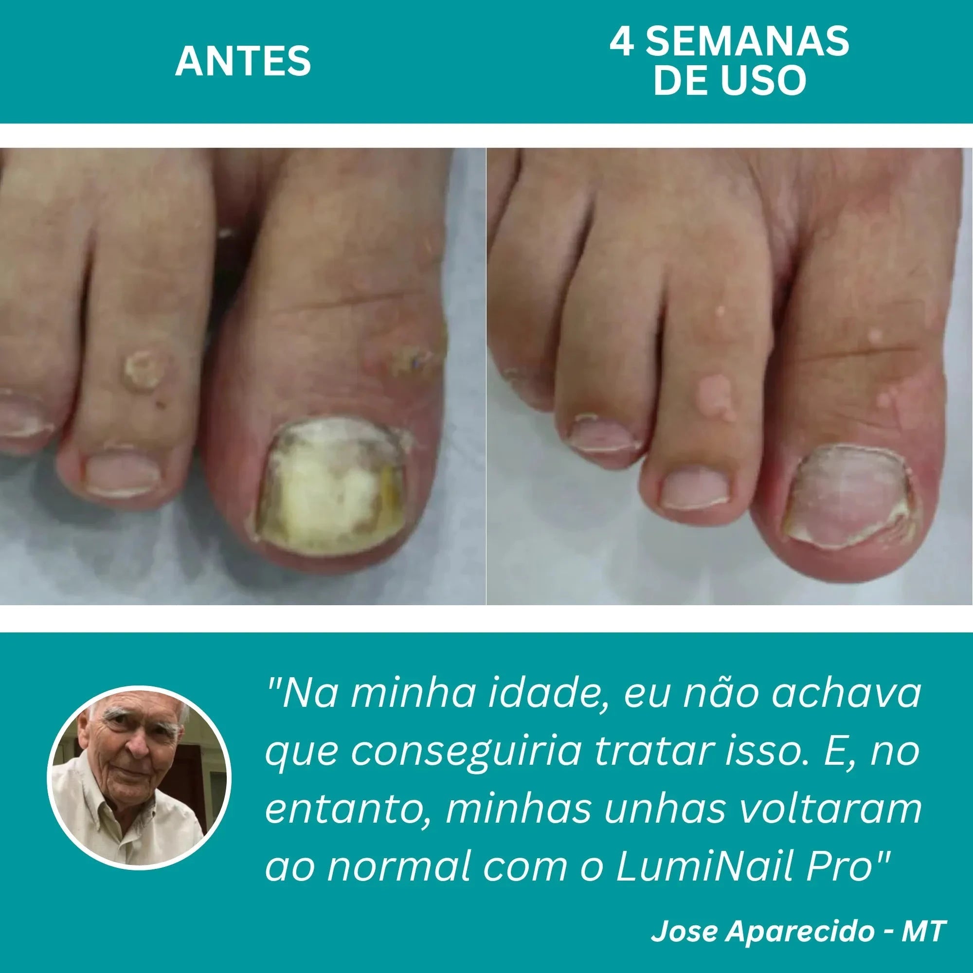 LumiNail Pro - Direct Ofertas