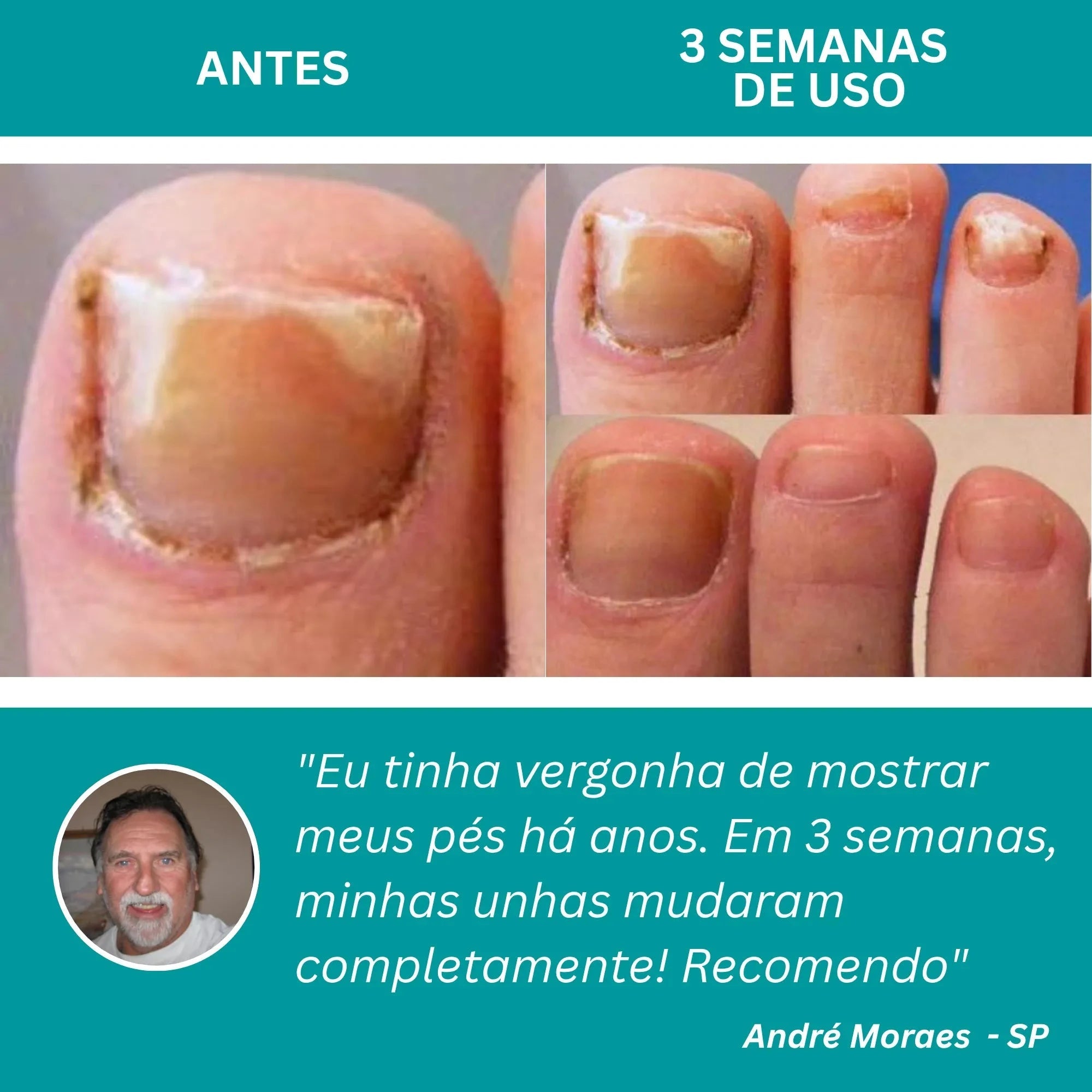 LumiNail Pro - Direct Ofertas
