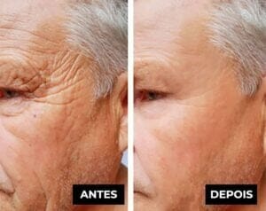 LuteinaRoll 5 em 1 ORIGINAL - Remove Olheiras, Reduz Bolsas e Revitaliza a Pele ao Redor dos Olhos - Direct Ofertas