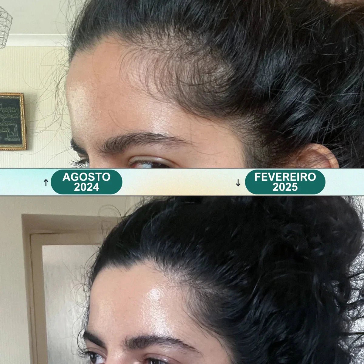 Massageador Elétrico para Couro Cabeludo - Renova Hair - Direct Ofertas