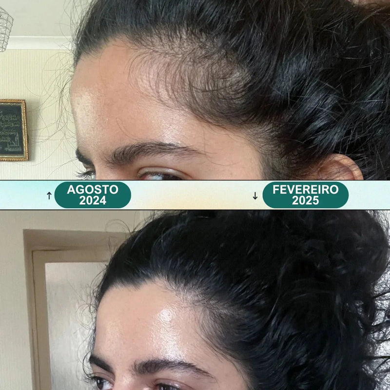 Massageador Elétrico para Couro Cabeludo - Renova Hair - Direct Ofertas
