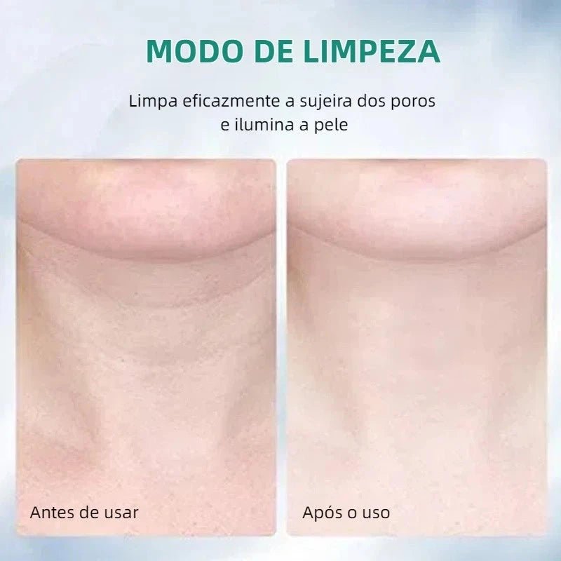 Massageador Facial com Fototerapia Anti - Rugas - Direct Ofertas