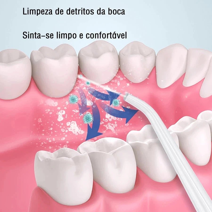 OralFlow + Kit de Acessórios Grátis! - Direct Ofertas