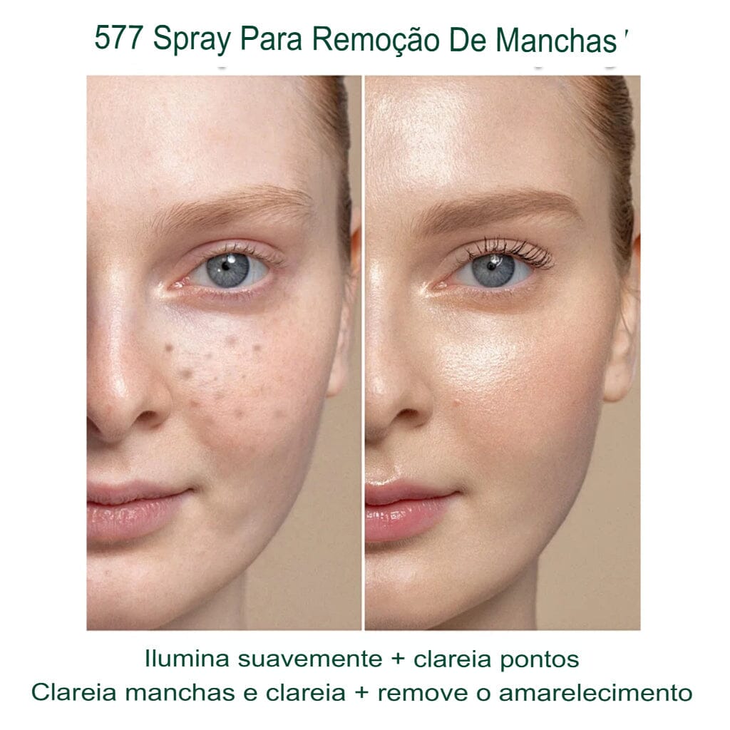 Revitta 577 Spray - Remove manchas de SOL, IDADE E MELASMA! - Direct Ofertas