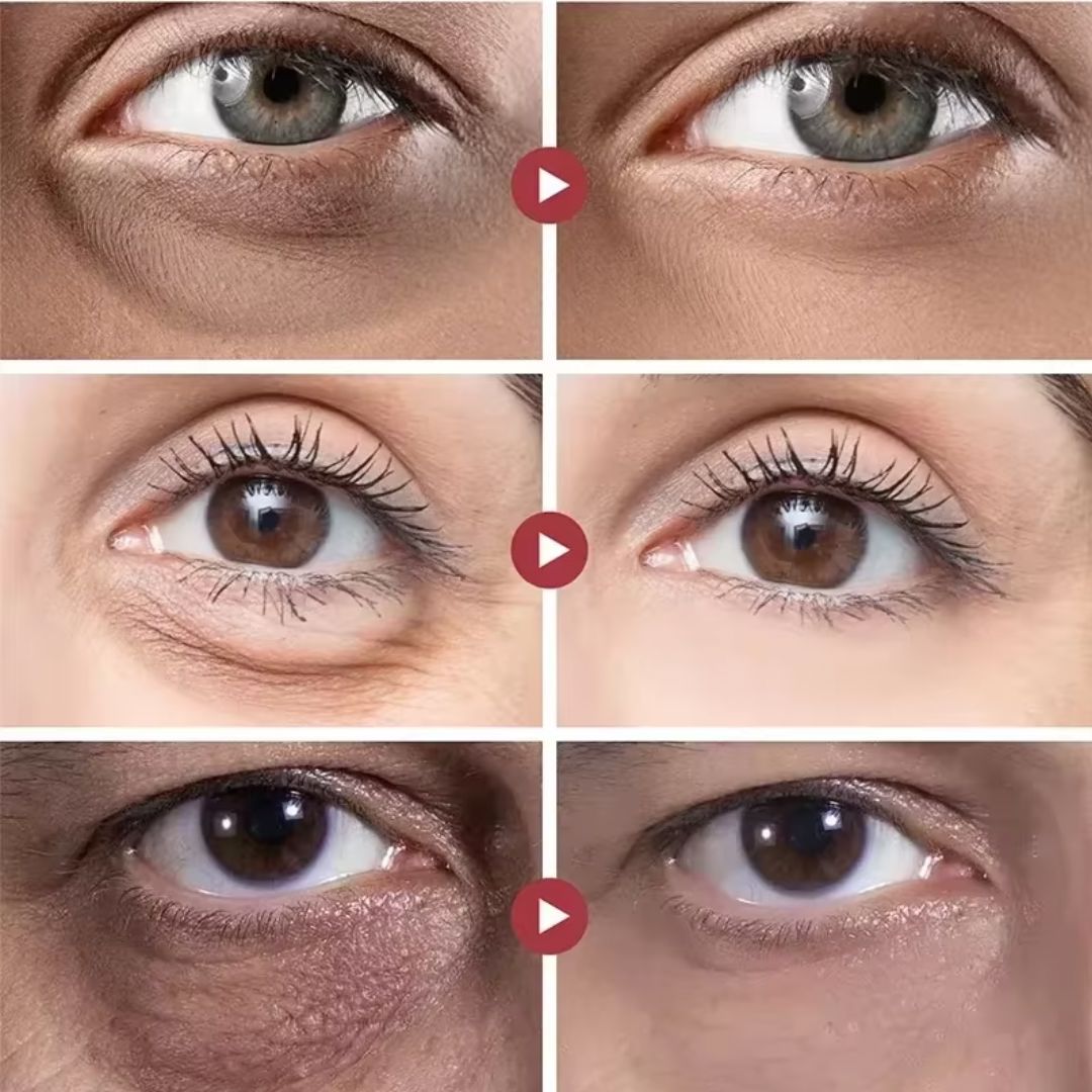 Rolon 5 em 1 Ultra Rejuvenescedor - Luteína Glow® - Direct Ofertas