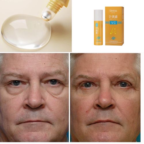 Rolon 5 em 1 Ultra Rejuvenescedor - Luteína Glow® - Direct Ofertas