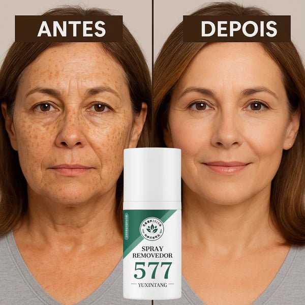Spray Removedor de manchas de Sol, IDADE E MELASMA! Desconto+ Frete Grátis - Direct Ofertas