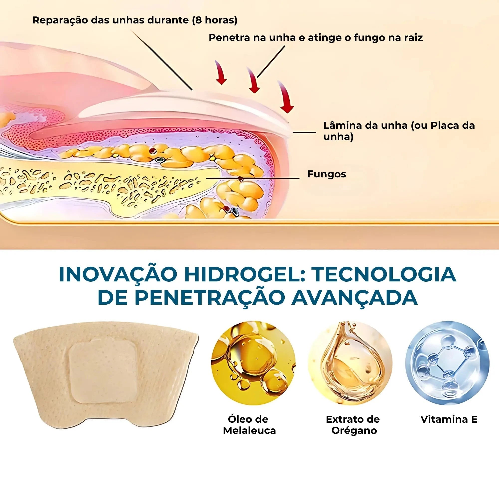 UngiGel - Adesivos para fungos UngiGel - Adesivos para fungos P11 Direct Ofertas 